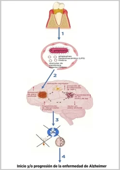 Efectos-de-P-gingivalis-en-cerebro